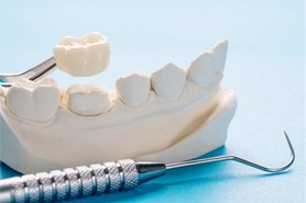 A dental crown hanging over a dental bridge model and some dental tools